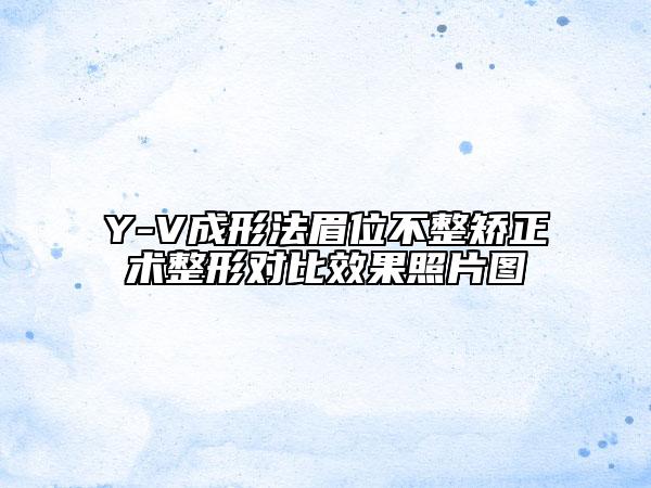 Y-V成形法眉位不整矯正術整形對比效果照片圖