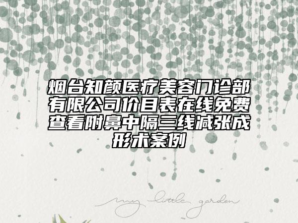 煙臺知顏醫(yī)療美容門診部有限公司價目表在線免費查看附鼻中隔三線減張成形術(shù)案例