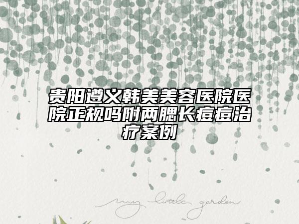 貴陽遵義韓美美容醫(yī)院醫(yī)院正規(guī)嗎附兩腮長痘痘治療案例