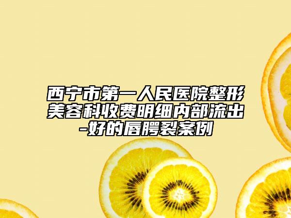 西寧市第一人民醫(yī)院整形美容科收費(fèi)明細(xì)內(nèi)部流出-好的唇腭裂案例
