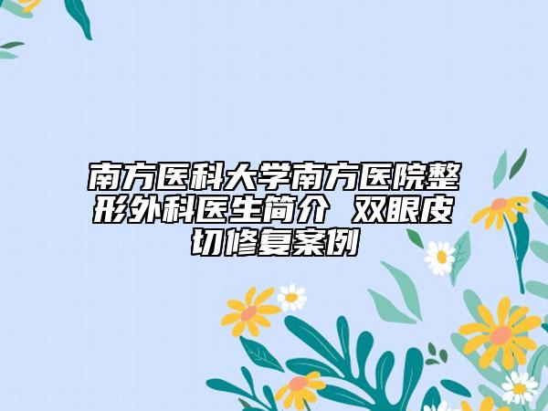 南方醫(yī)科大學(xué)南方醫(yī)院整形外科醫(yī)生簡(jiǎn)介 雙眼皮切修復(fù)案例