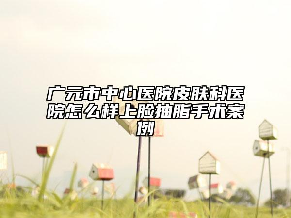 廣元市中心醫(yī)院皮膚科醫(yī)院怎么樣上臉抽脂手術(shù)案例