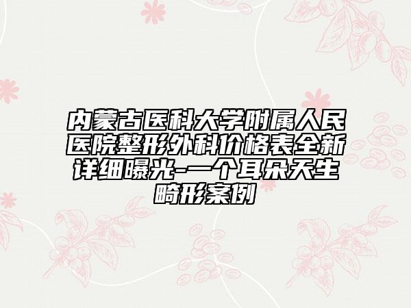 內(nèi)蒙古醫(yī)科大學附屬人民醫(yī)院整形外科價格表全新詳細曝光-一個耳朵天生畸形案例