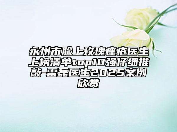 永州市臉上玫瑰痤瘡醫(yī)生上榜清單top10強(qiáng)仔細(xì)推敲-雷磊醫(yī)生2025案例欣賞